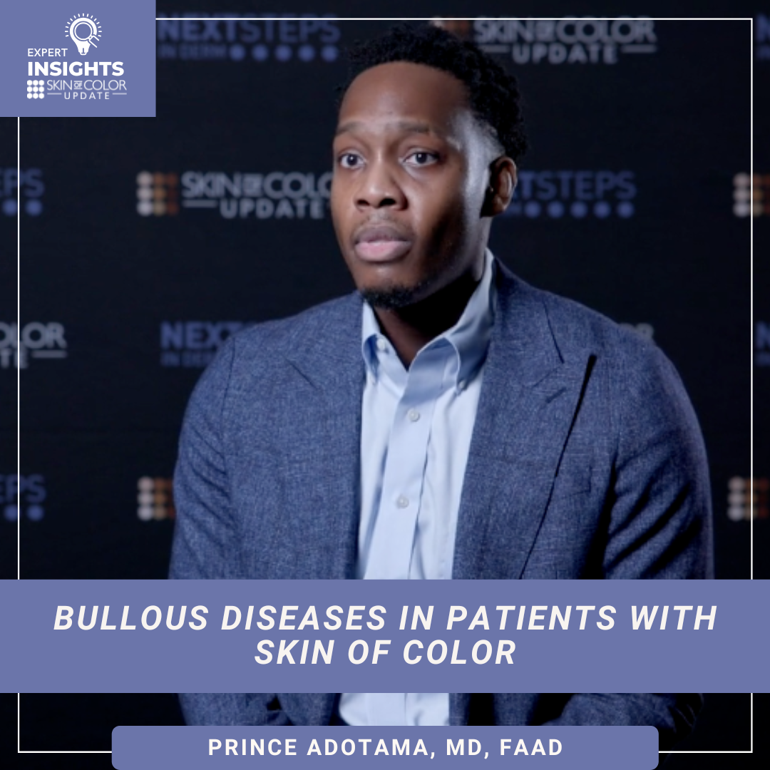 bullous pemphigoid in skin of color