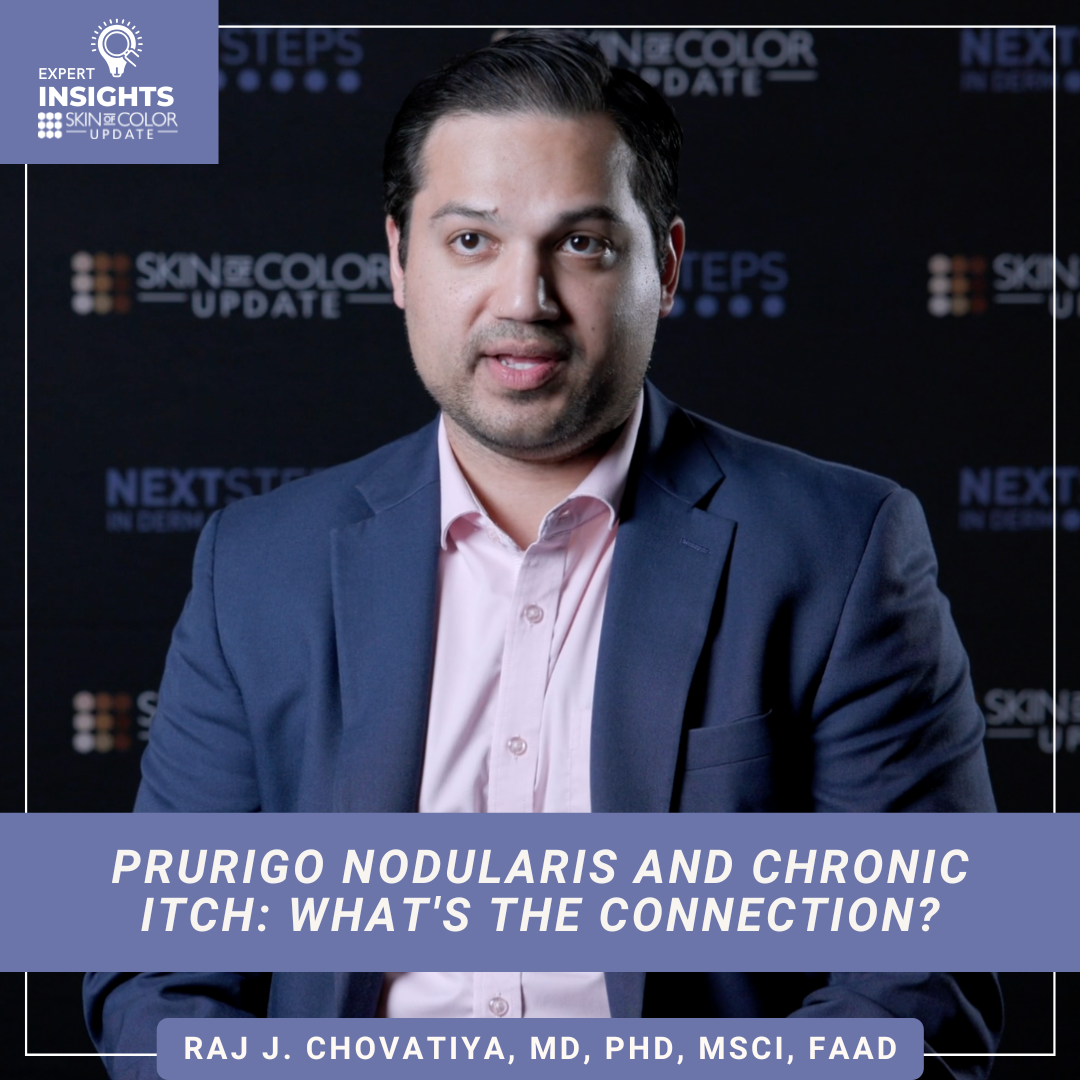 prurigo nodularis and chronic itch