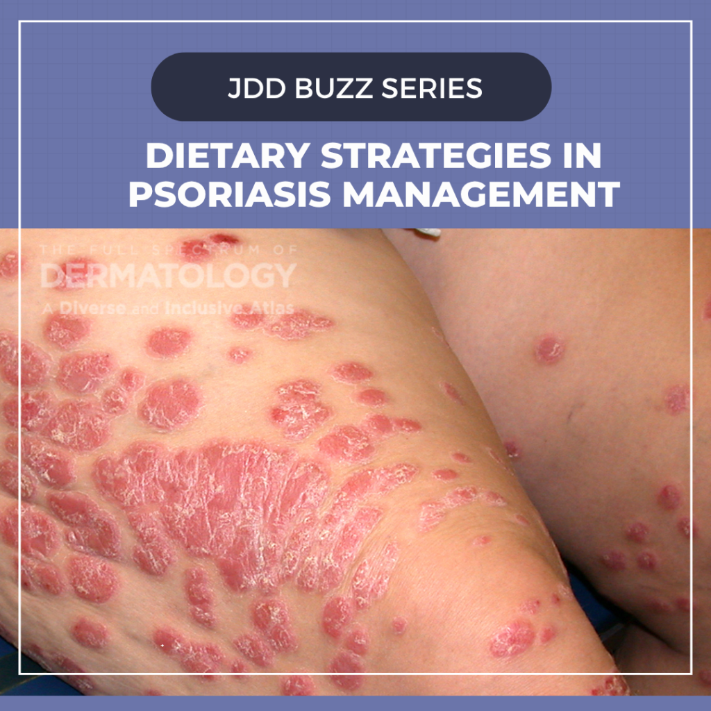 dietary strategies in psoriasis