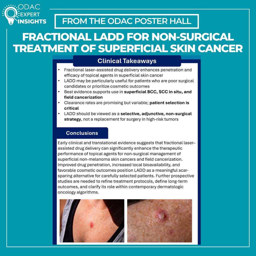 non-surgical skin cancer treatment