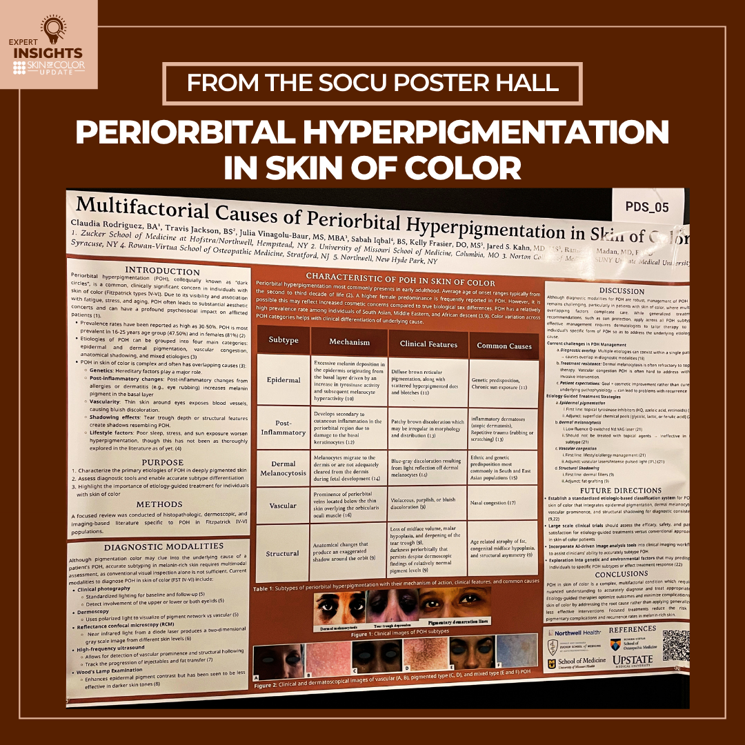 Periorbital Hyperpigmentation in Skin of Color