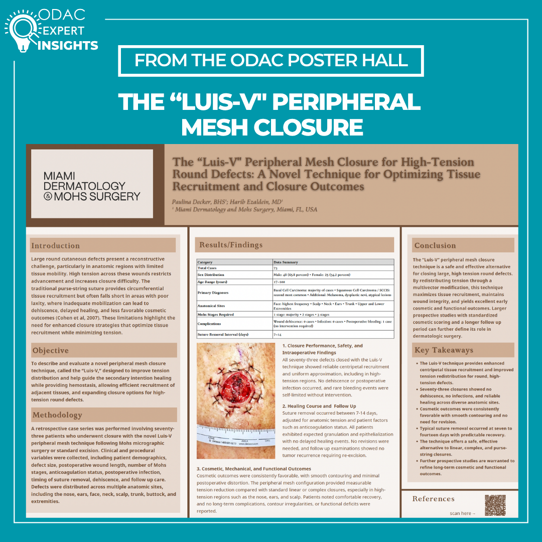 Luis-V Peripheral Mesh Closure